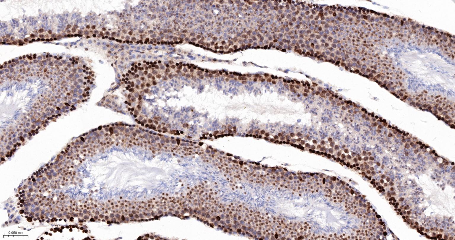 PRPF19重组兔单抗