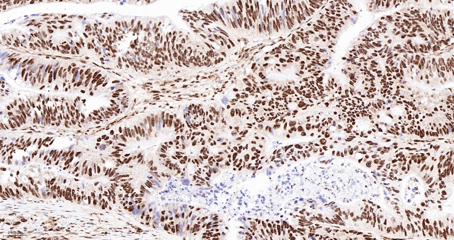 PRPF19重组兔单抗