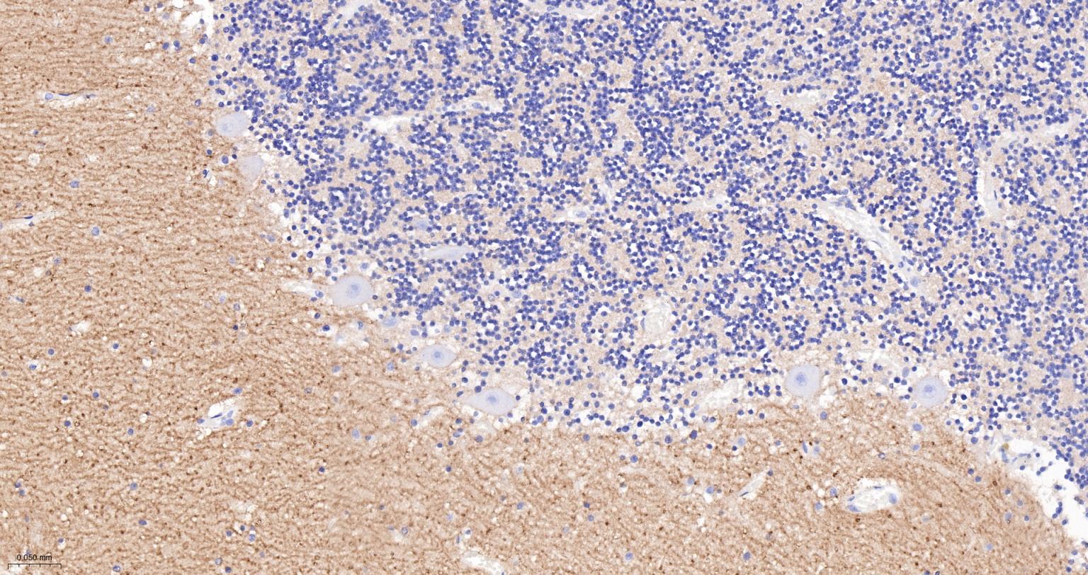 神经细胞粘附分子1重组兔单抗