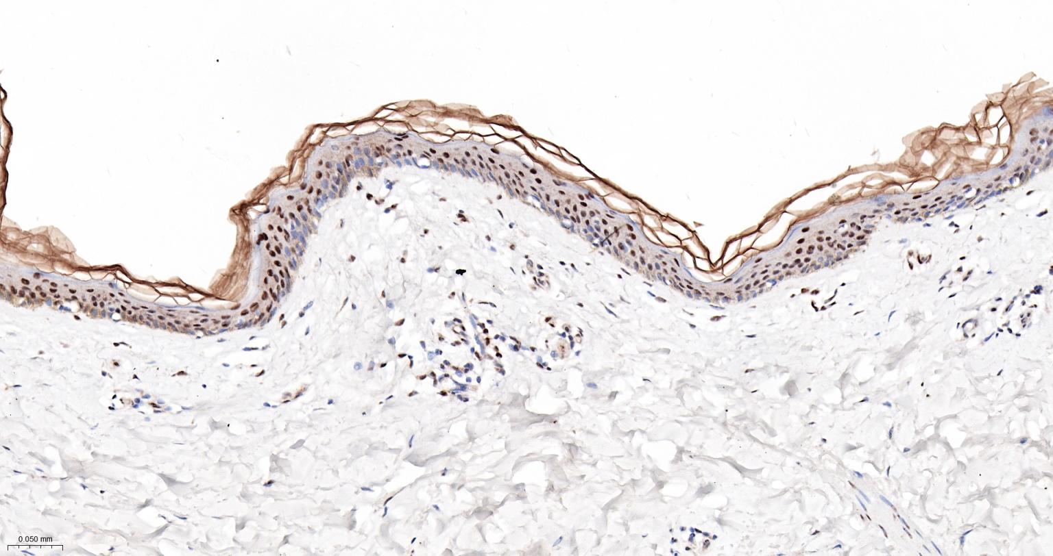 PRPF19重组兔单抗