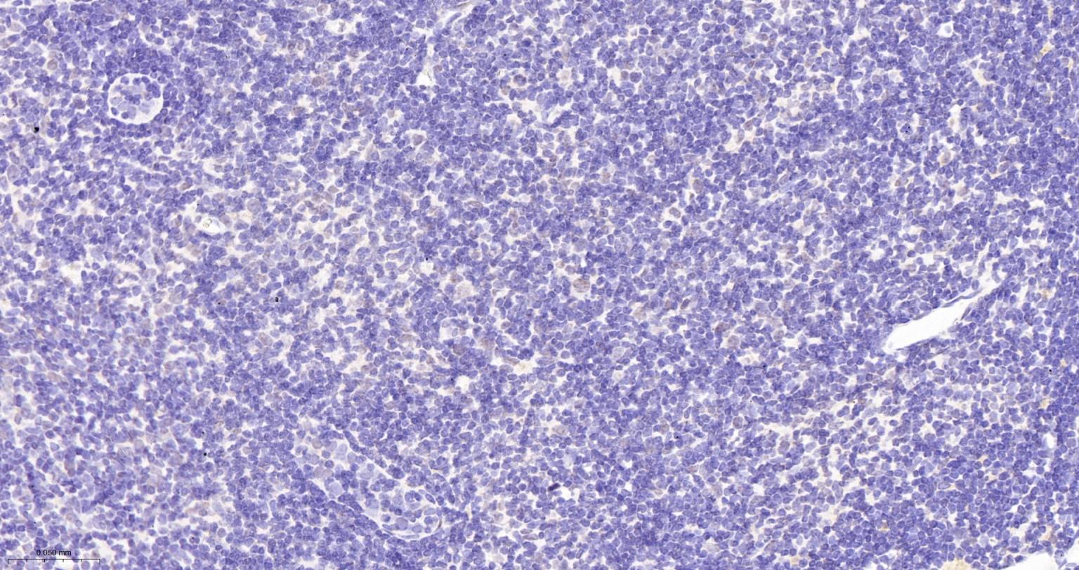 锌指蛋白Aiolos重组兔单抗-bsm-62807R