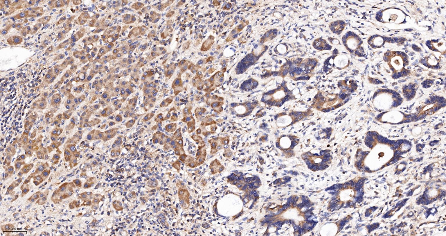 葡萄糖-6磷酸脱氢酶重组兔单抗