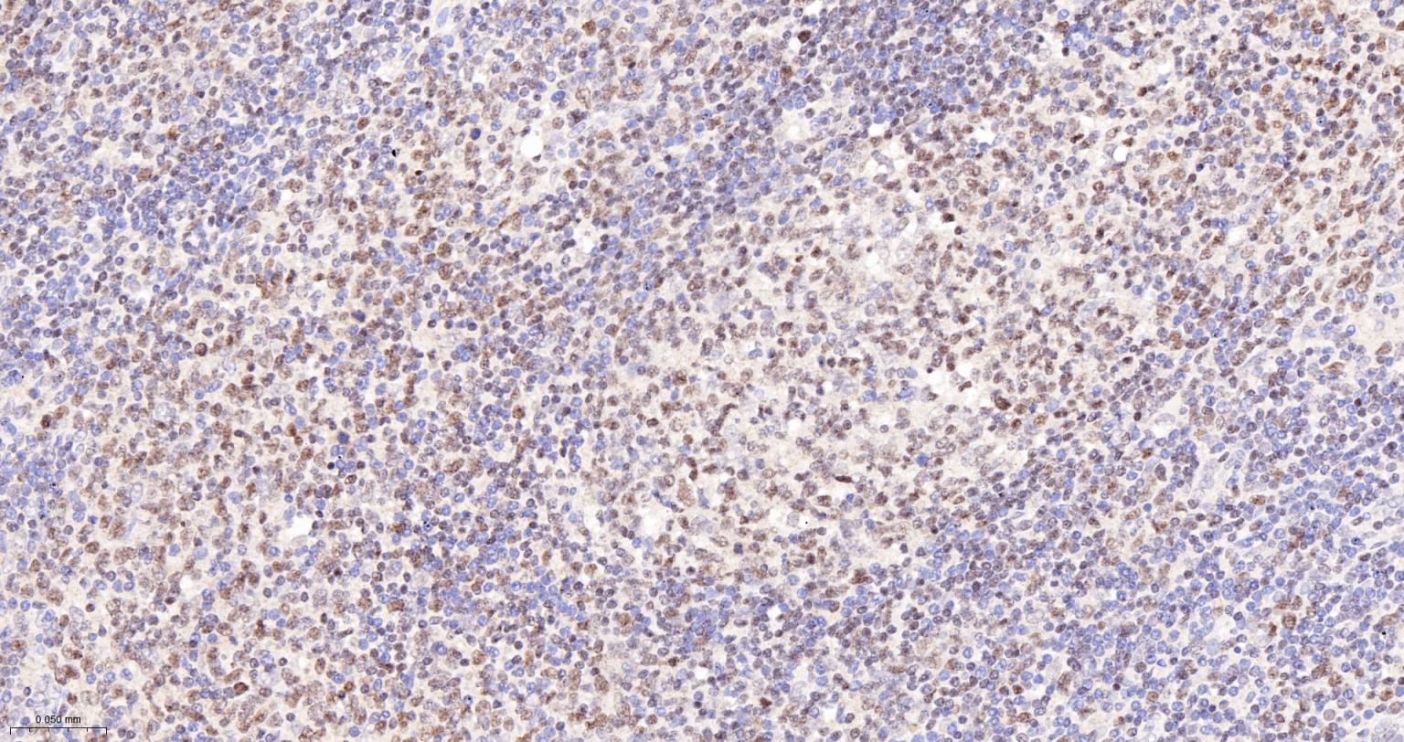 锌指蛋白Aiolos重组兔单抗-bsm-62807R