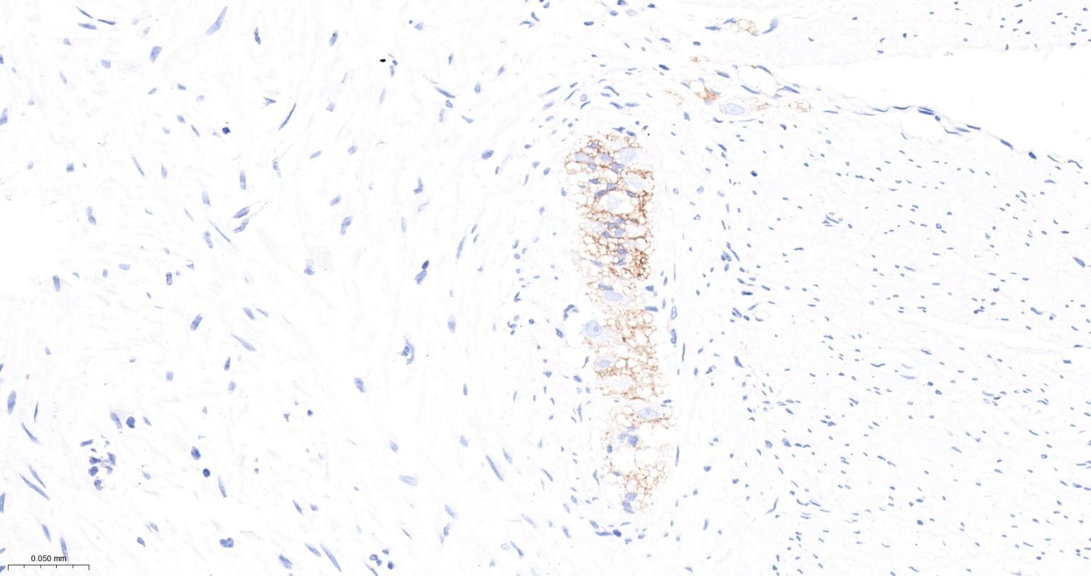 神经细胞粘附分子1重组兔单抗
