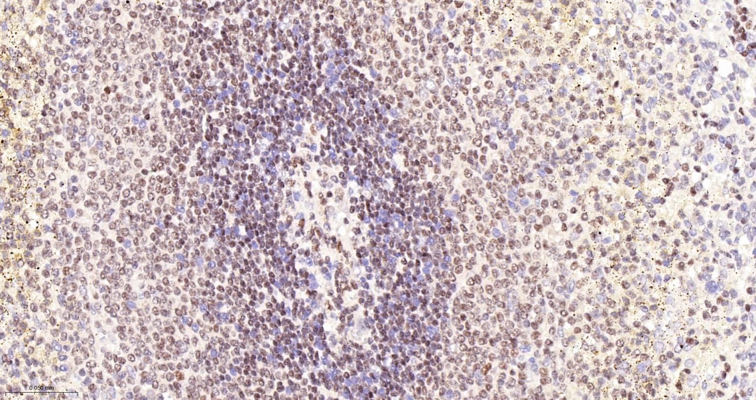 锌指蛋白Aiolos重组兔单抗-bsm-62807R