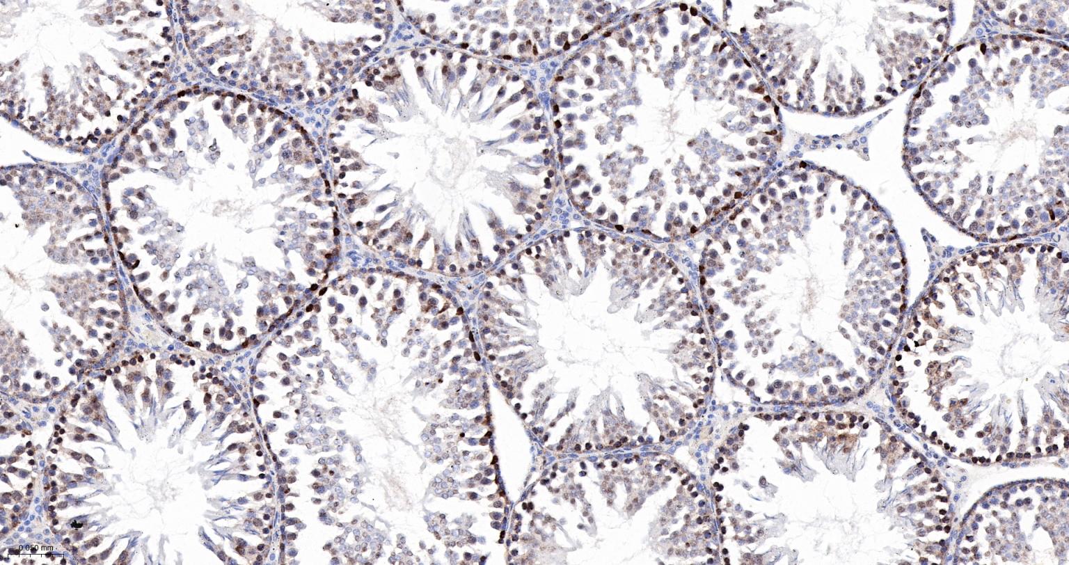 PRPF19重组兔单抗