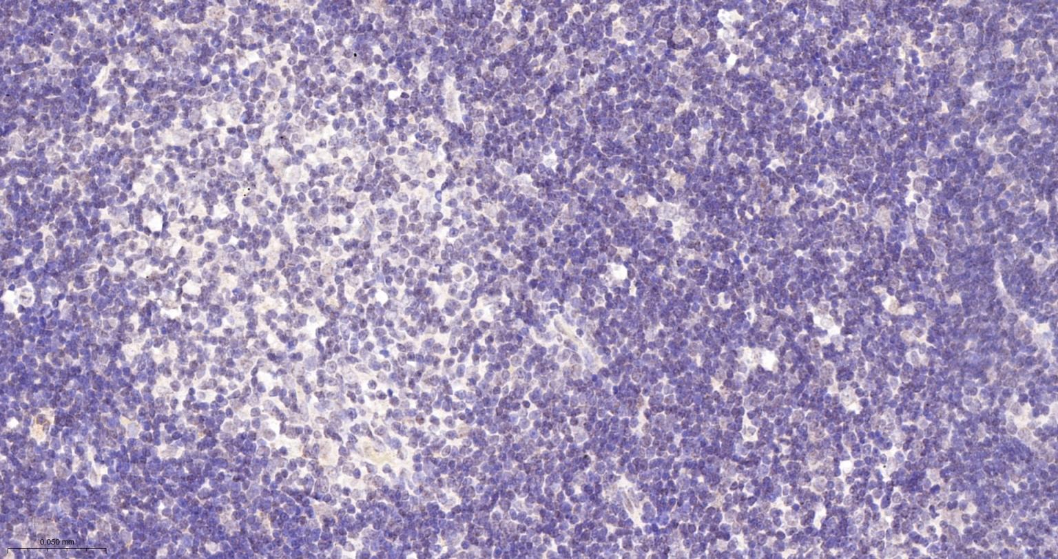 锌指蛋白Aiolos重组兔单抗-bsm-62807R