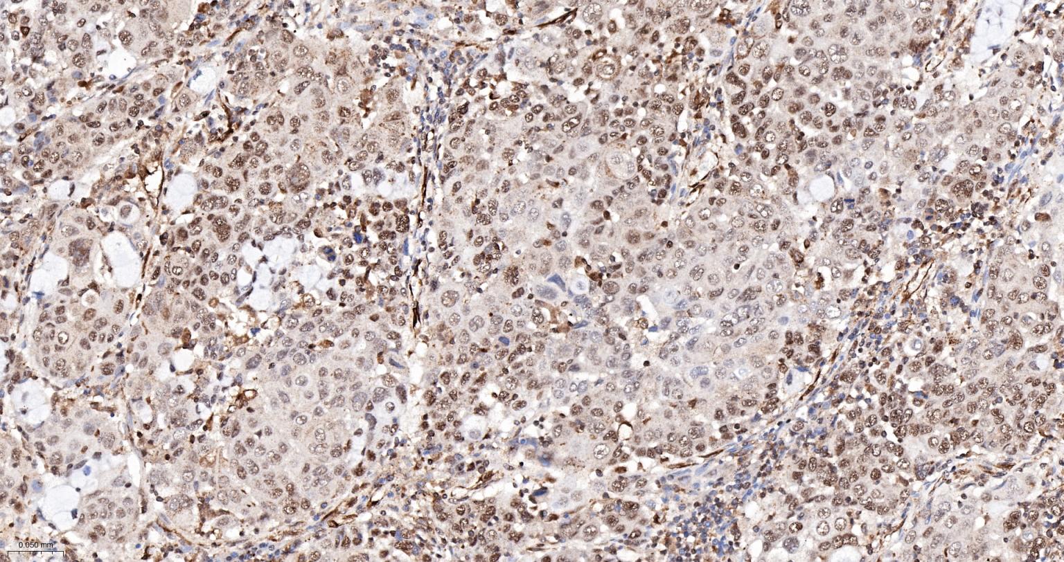 PRPF19重组兔单抗