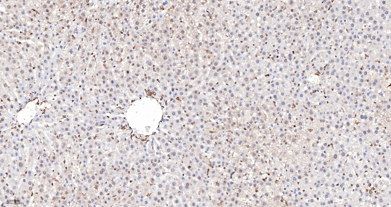 PRPF19重组兔单抗