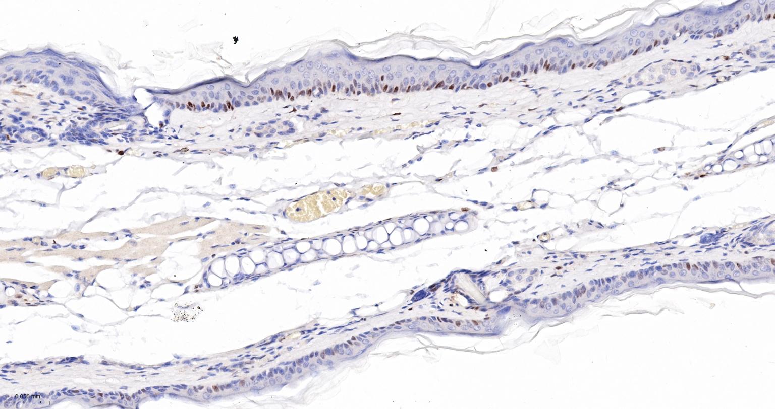 周期素D1重组兔单抗