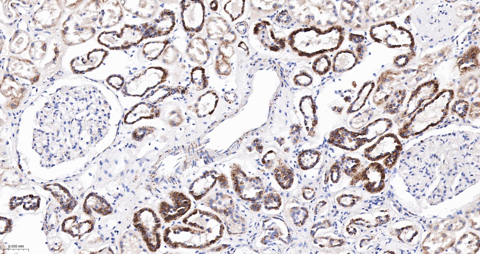 柠檬酸合成酶CISY重组兔单抗