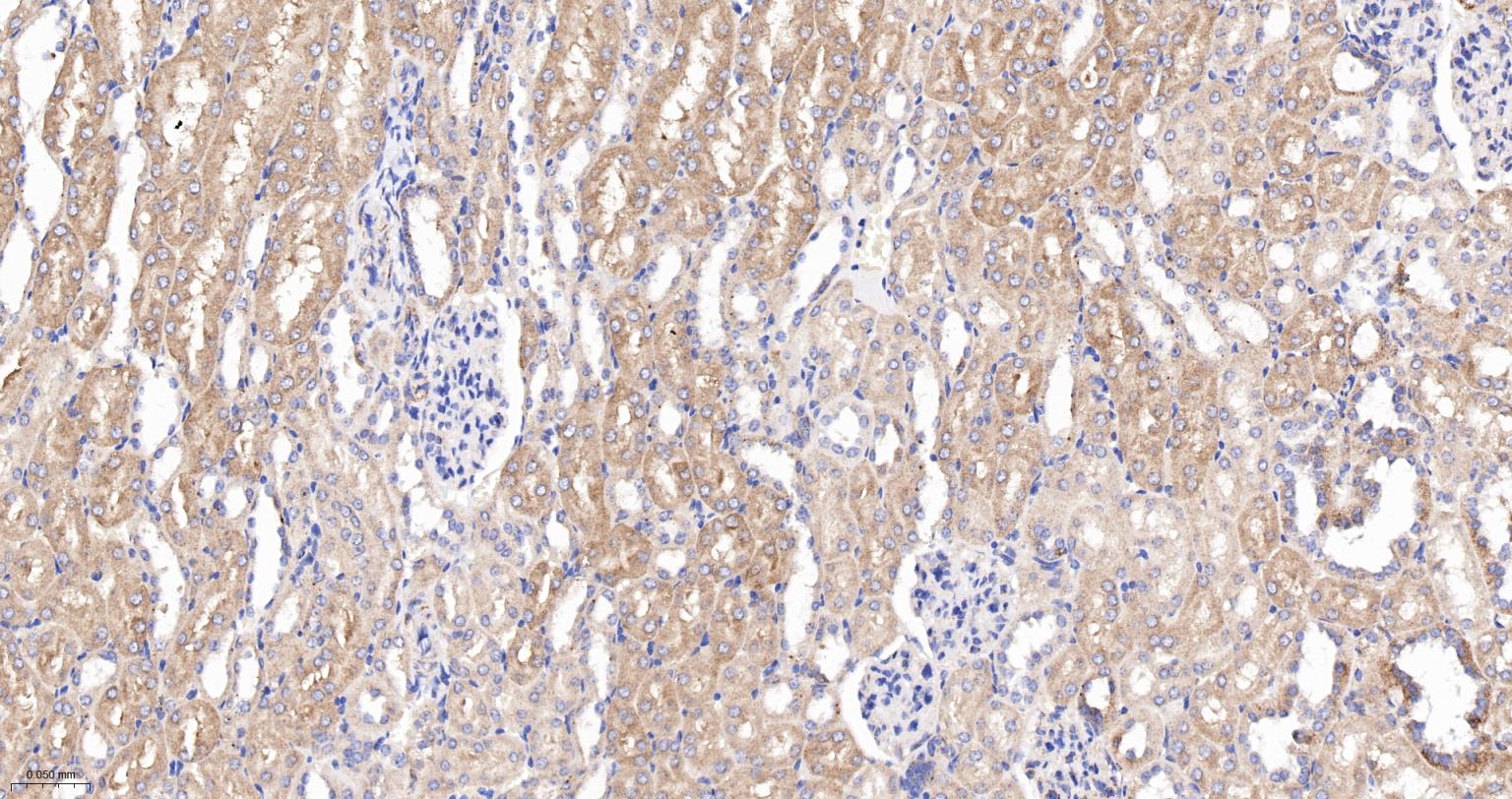 柠檬酸合成酶CISY重组兔单抗