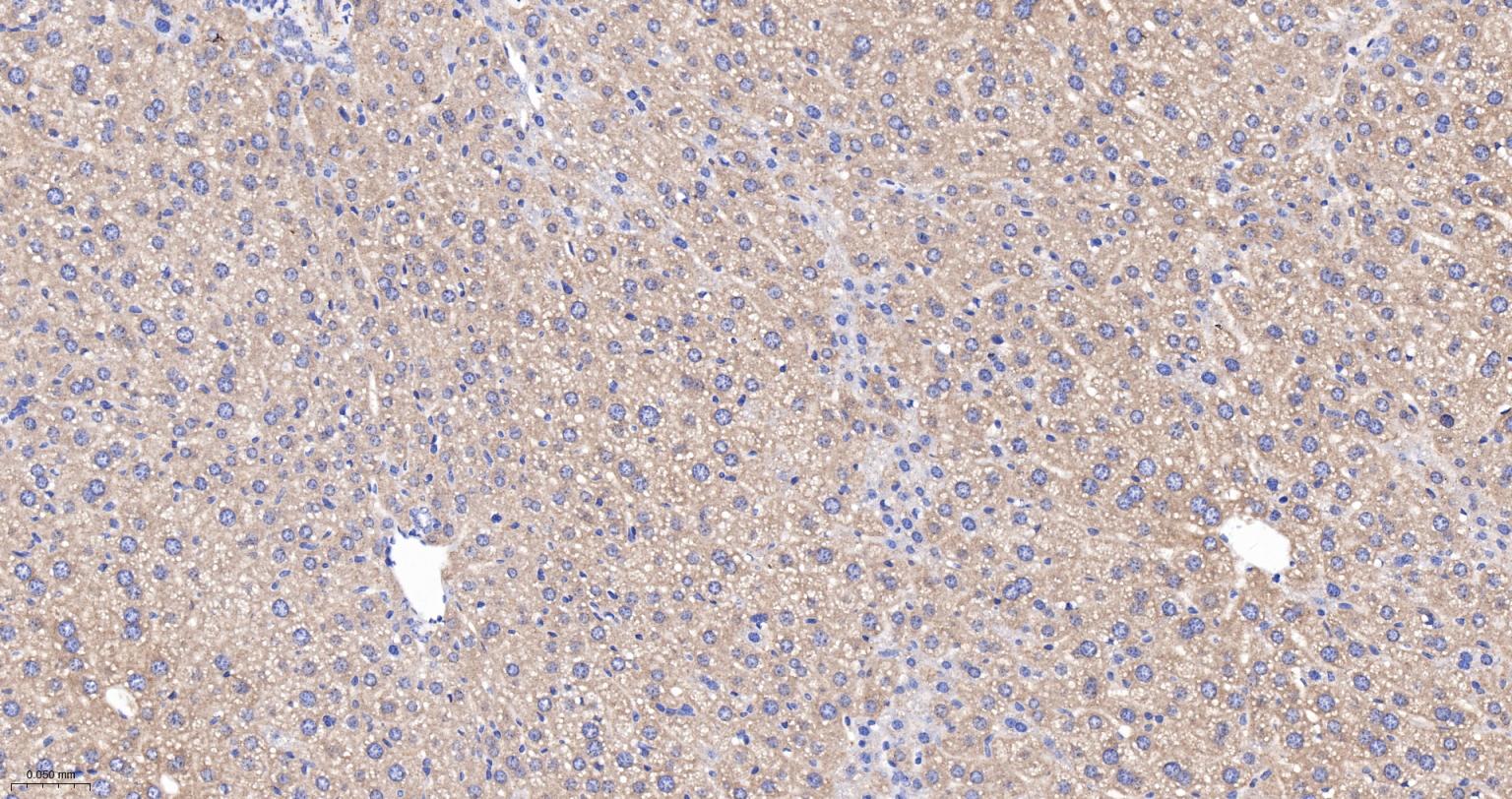 柠檬酸合成酶CISY重组兔单抗