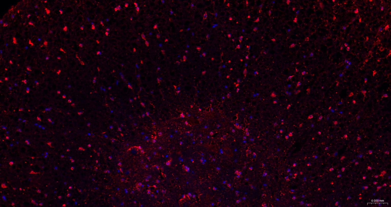 脑源神经营养因子重组兔单抗
