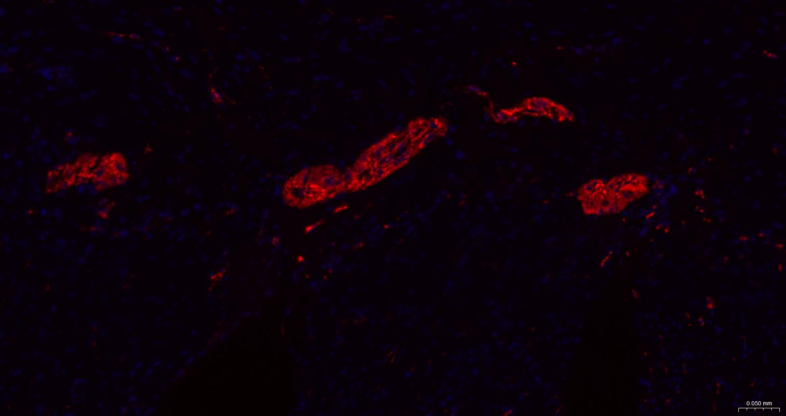 微管相关蛋白重组兔单抗
