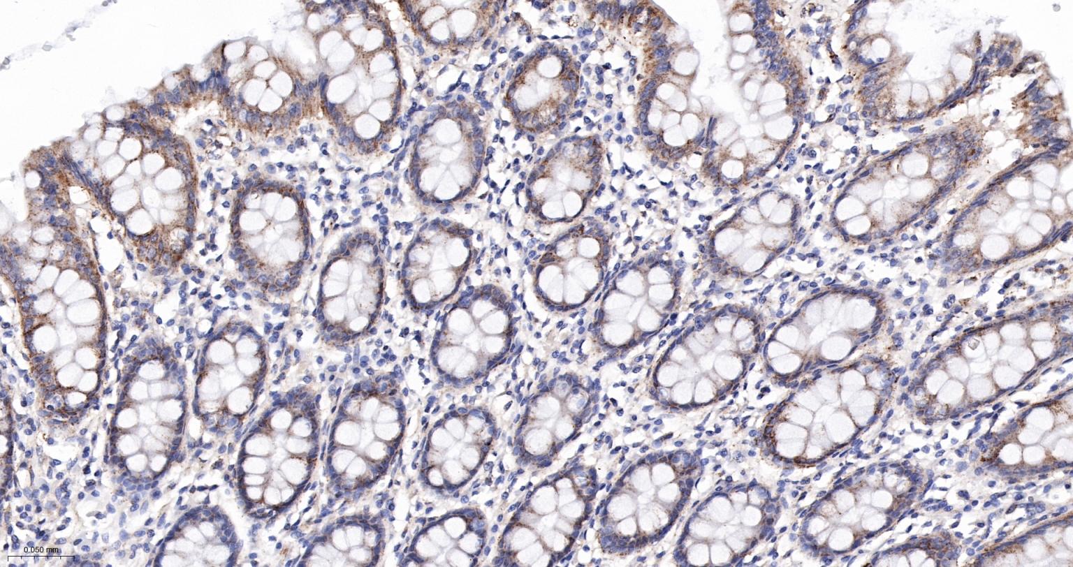 柠檬酸合成酶CISY重组兔单抗