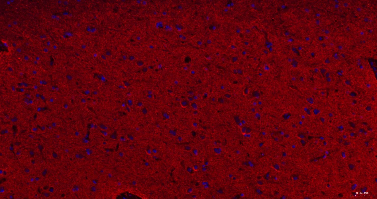 核突触蛋白-α重组兔单抗