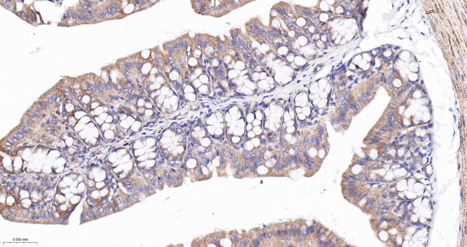 柠檬酸合成酶CISY重组兔单抗