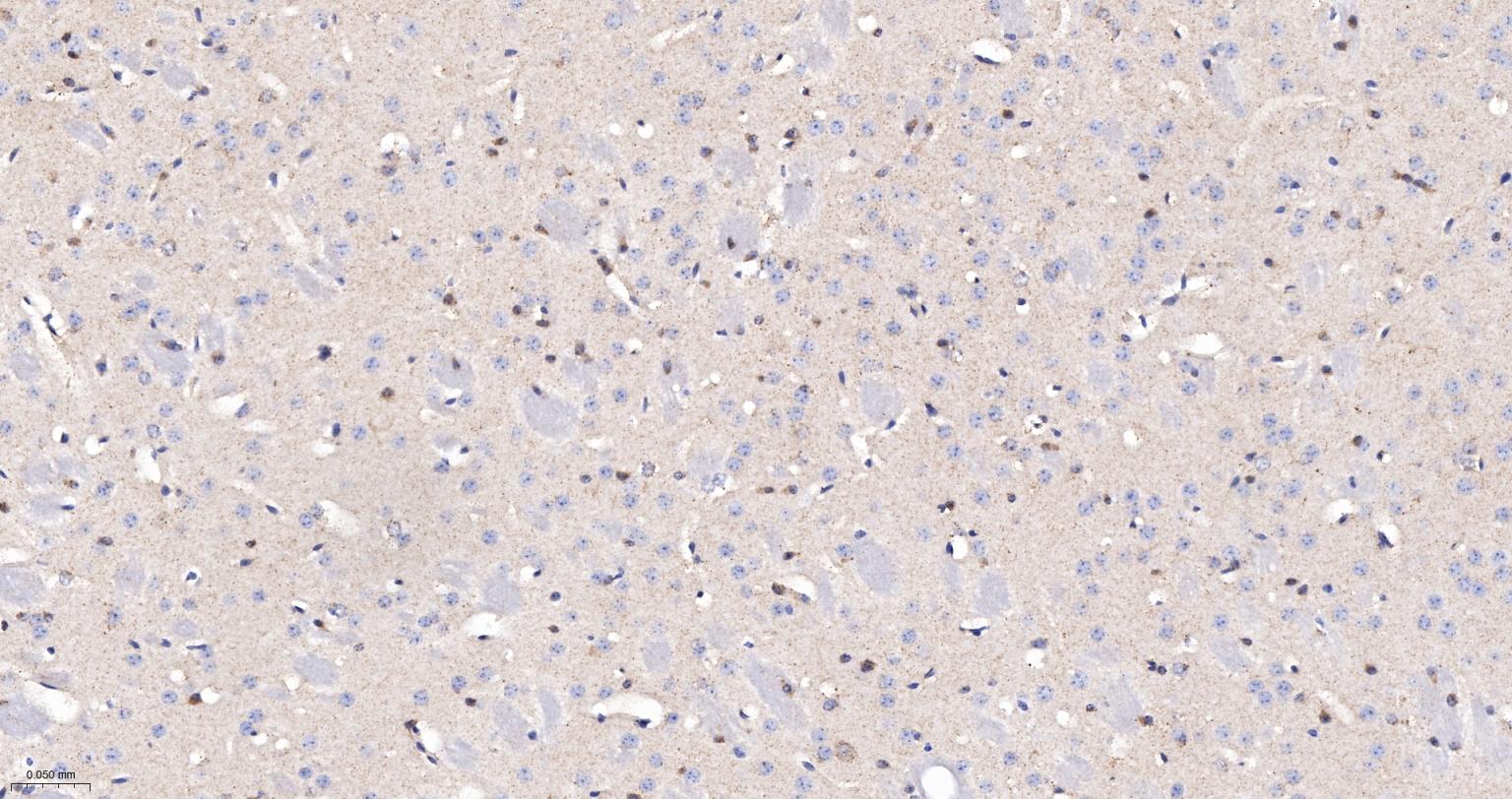 柠檬酸合成酶CISY重组兔单抗