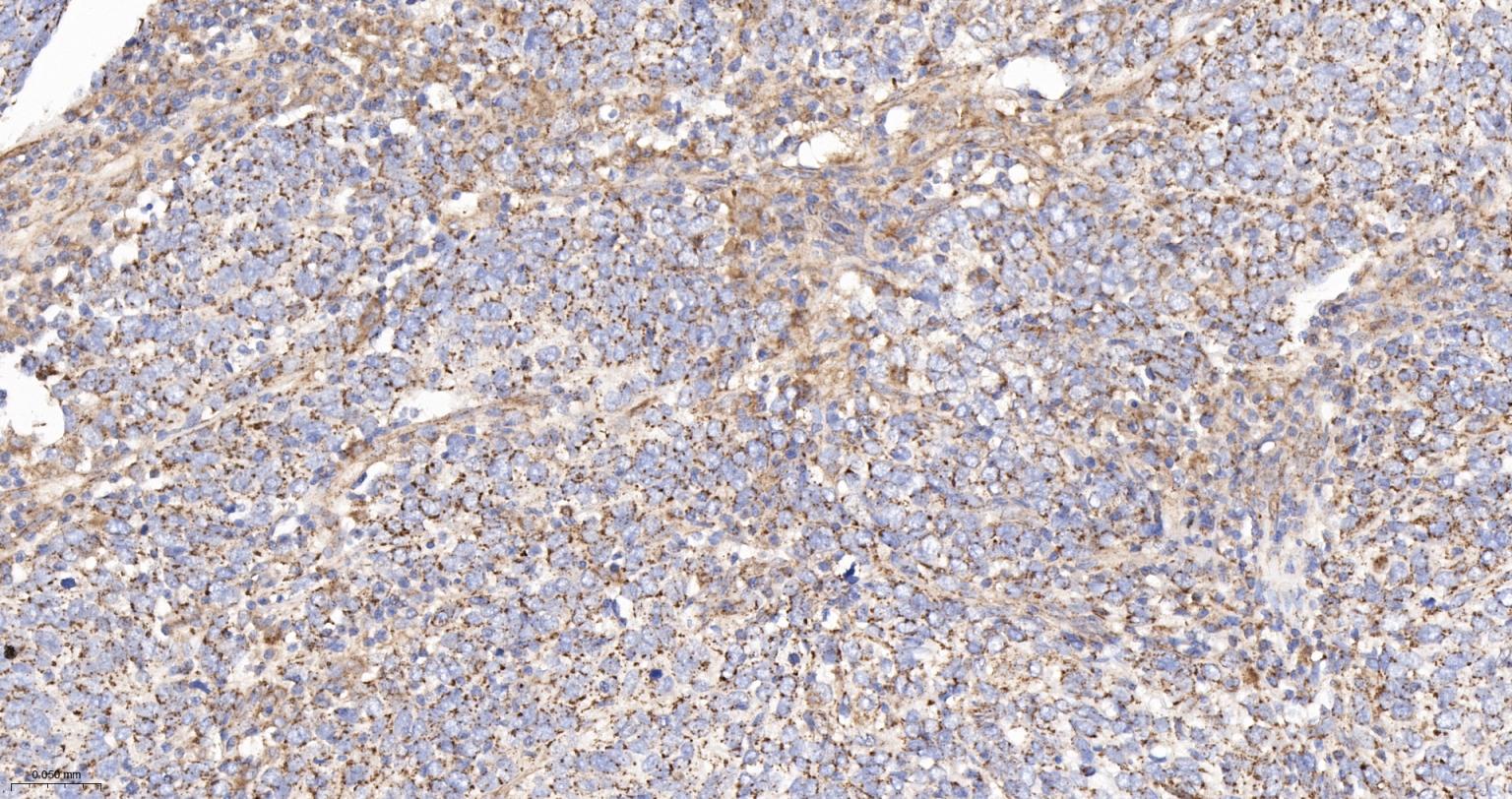 柠檬酸合成酶CISY重组兔单抗