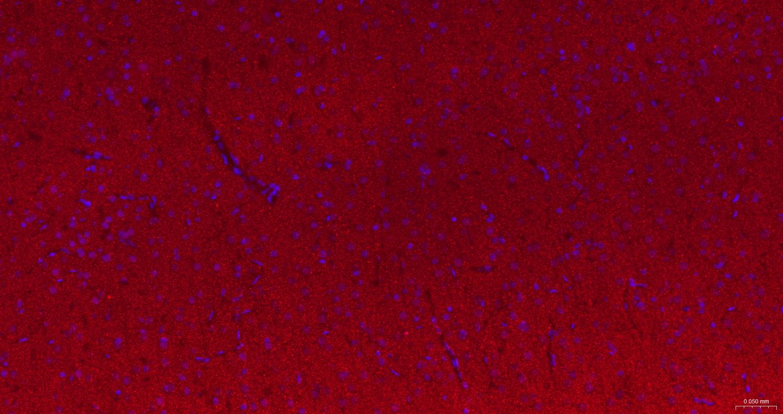 核突触蛋白-α重组兔单抗