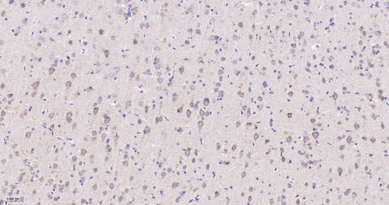 柠檬酸合成酶CISY重组兔单抗