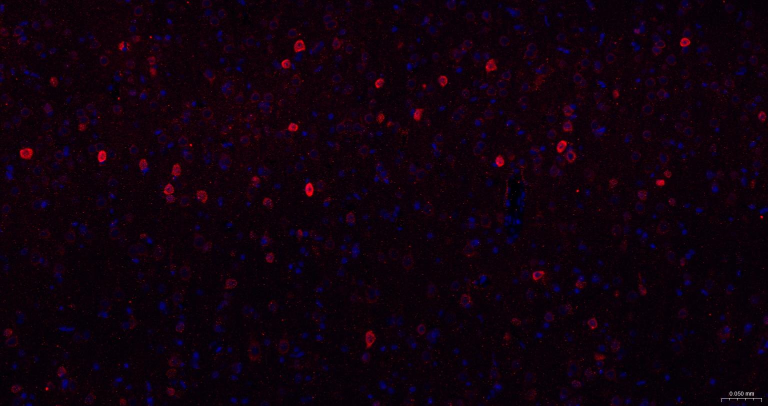 神经生长因子β重组兔单抗