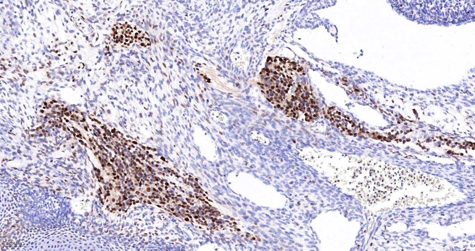 周期素D1重组兔单抗