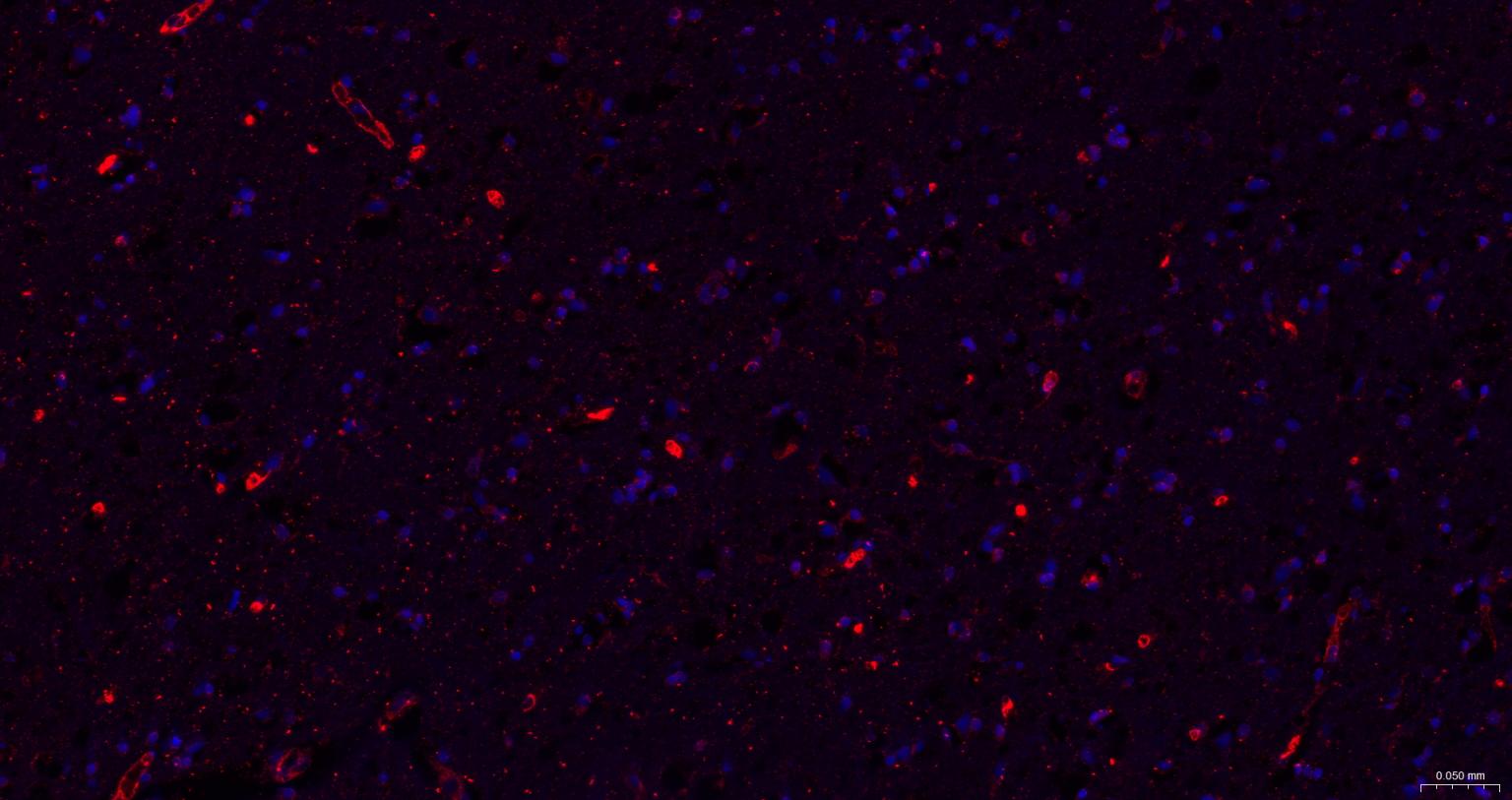脑源神经营养因子重组兔单抗