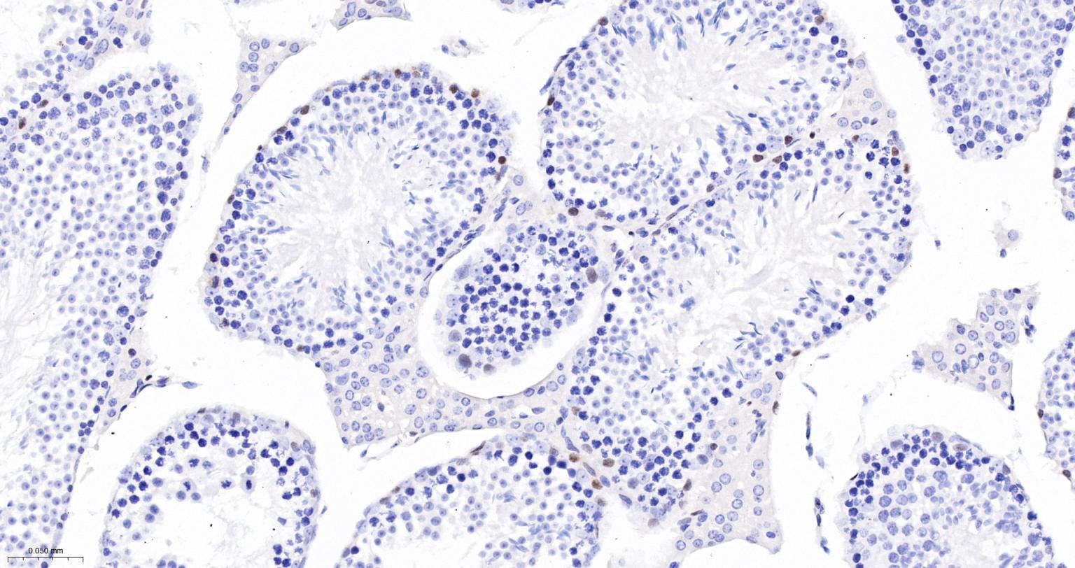周期素D1重组兔单抗