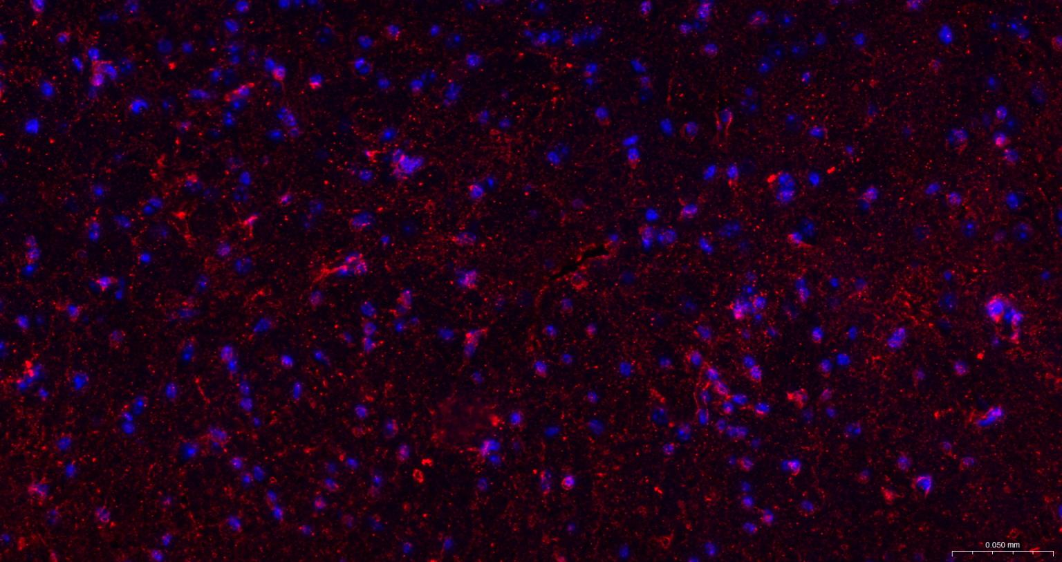 脑源神经营养因子重组兔单抗
