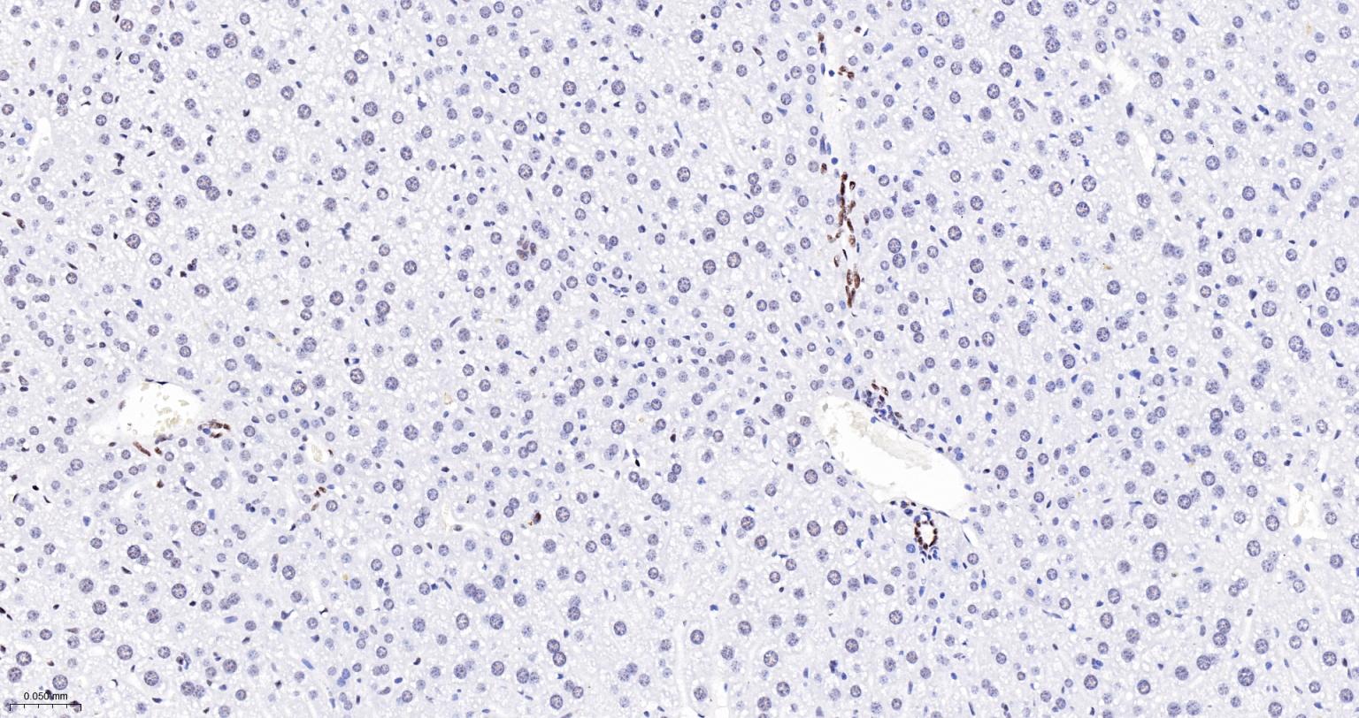 核呼吸因子-1重组兔单抗-bsm-54140R