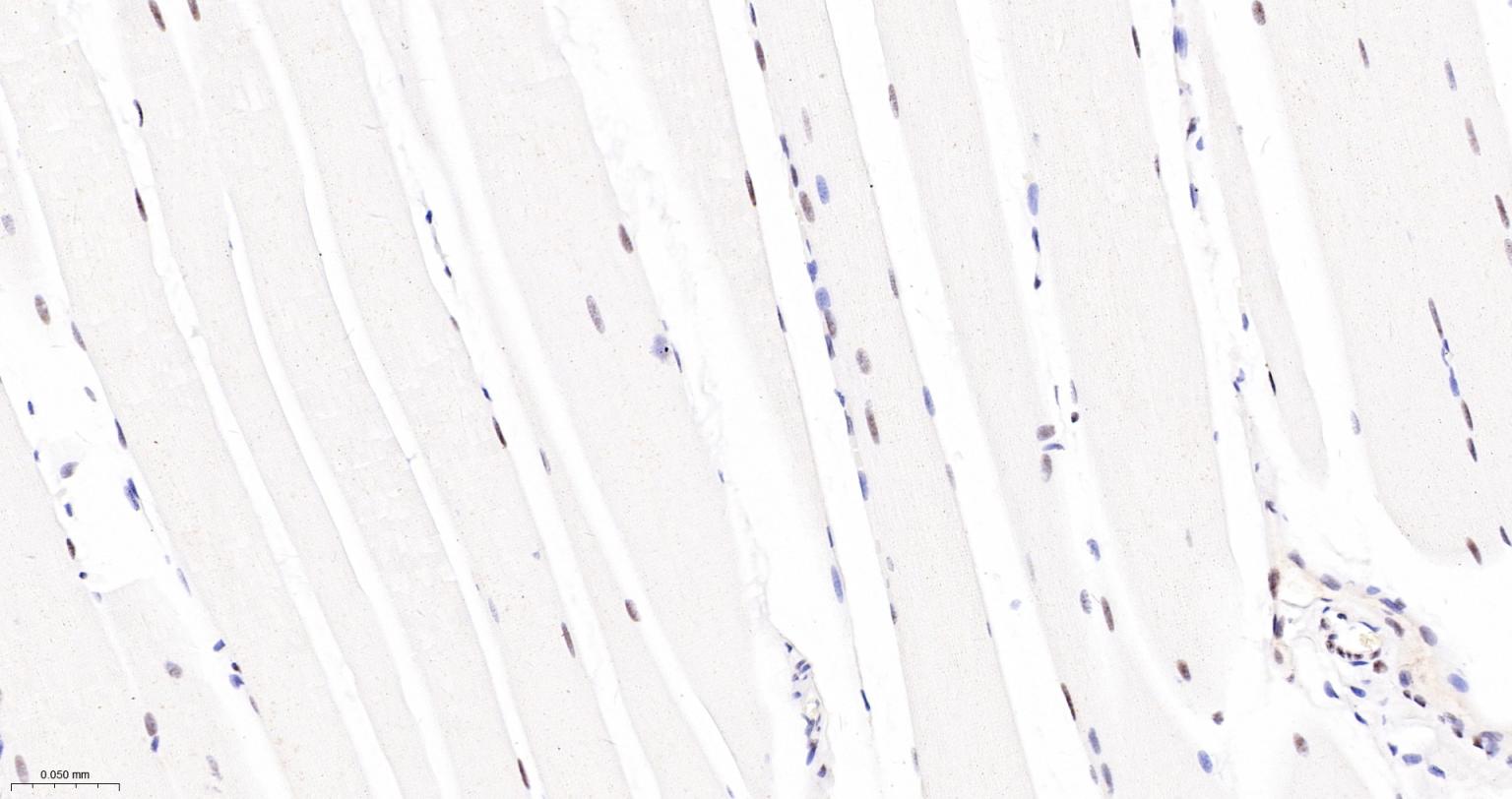 核呼吸因子-1重组兔单抗-bsm-54140R