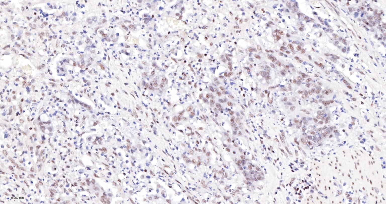 核呼吸因子-1重组兔单抗-bsm-54140R