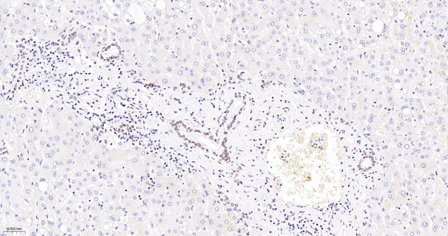 核呼吸因子-1重组兔单抗-bsm-54140R