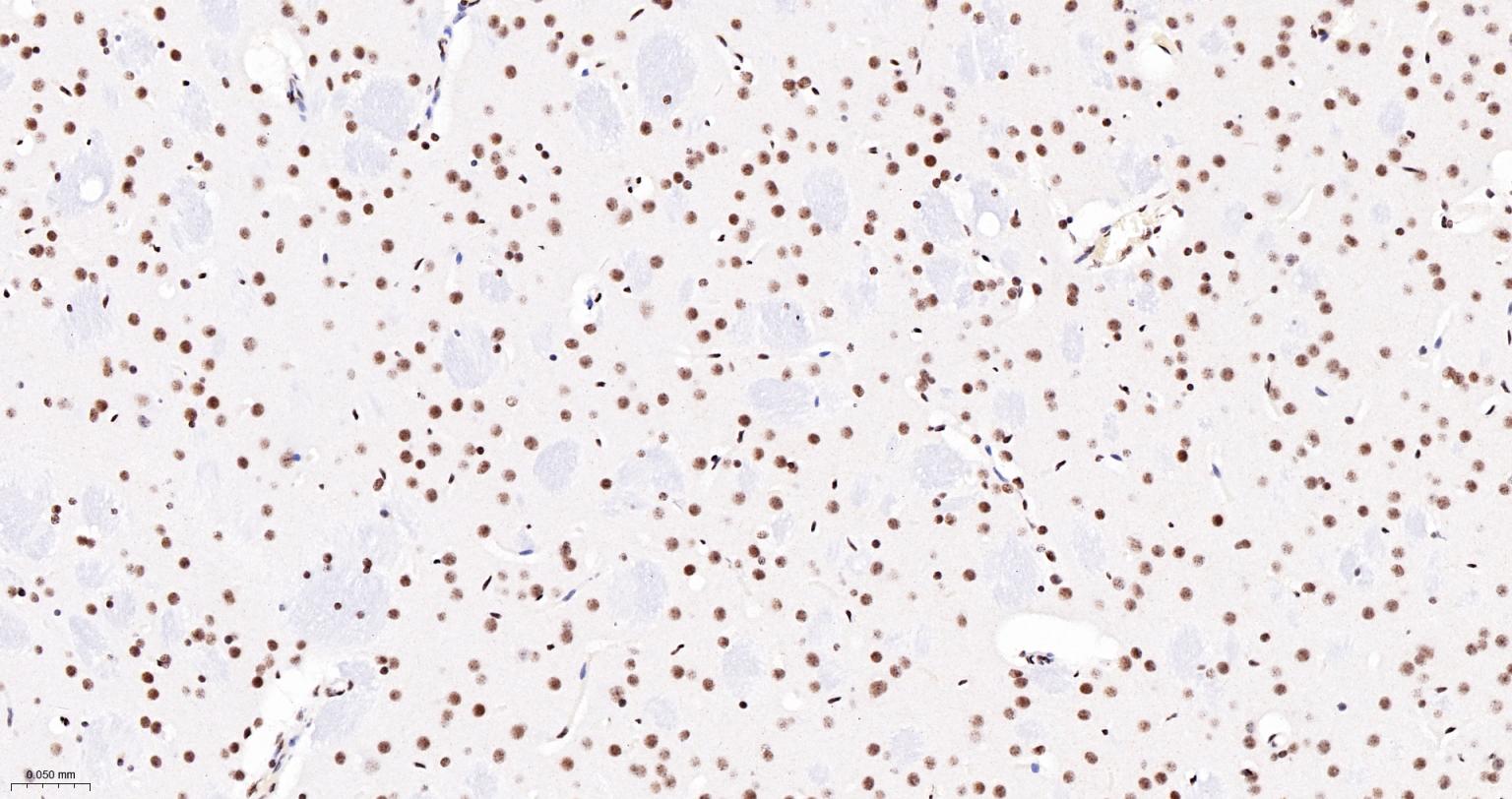 核呼吸因子-1重组兔单抗-bsm-54140R