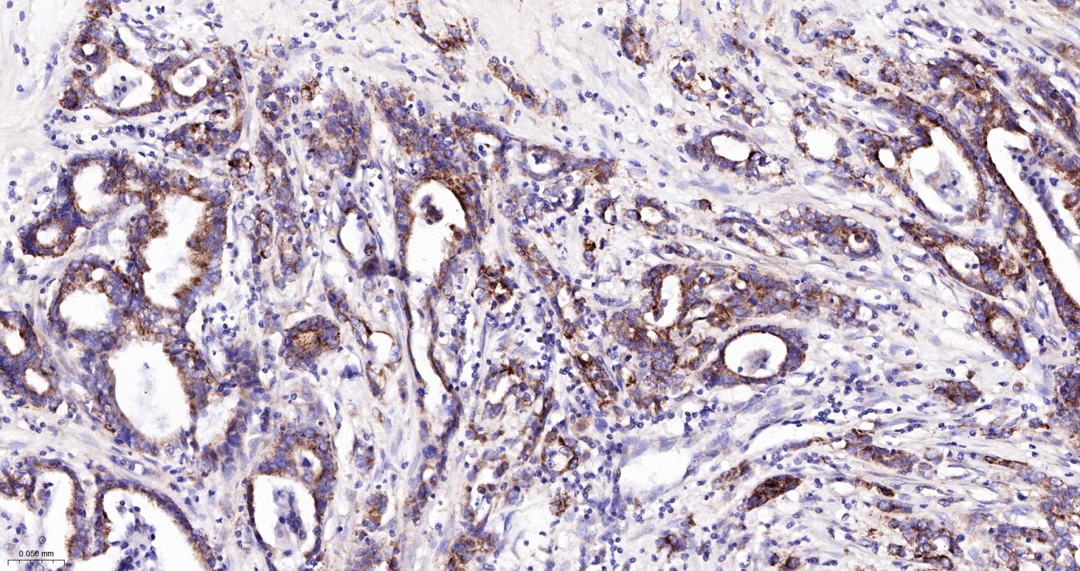 Bcl-2同源拮抗剂重组兔单抗