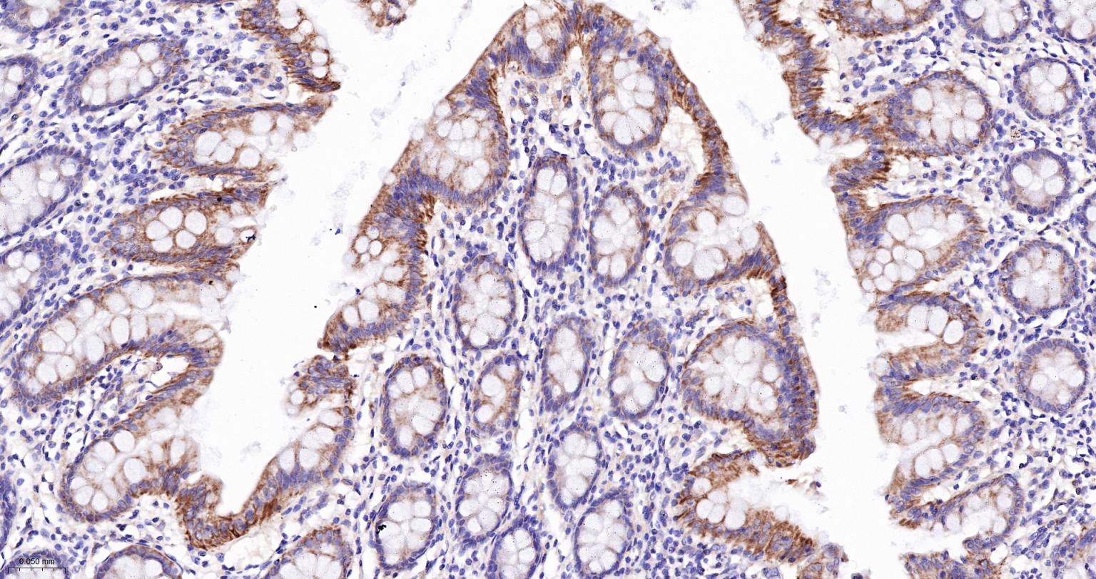 Bcl-2同源拮抗剂重组兔单抗