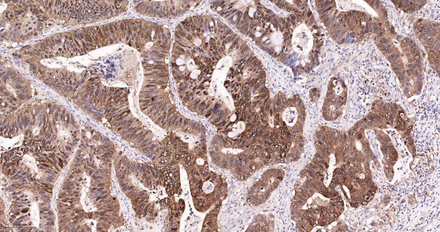 半乳糖凝集素3重组兔单抗