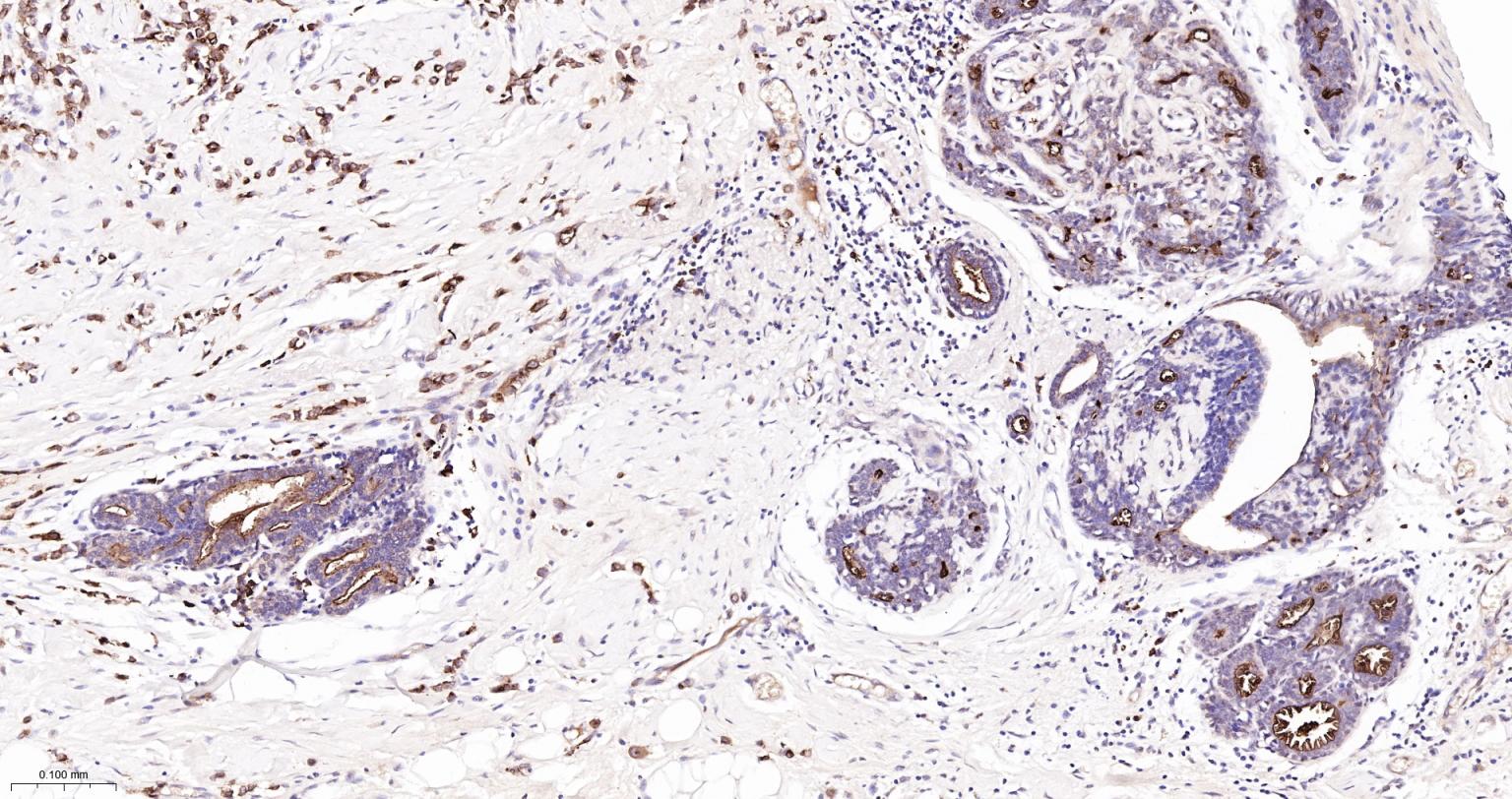 粘蛋白-1重组兔单抗