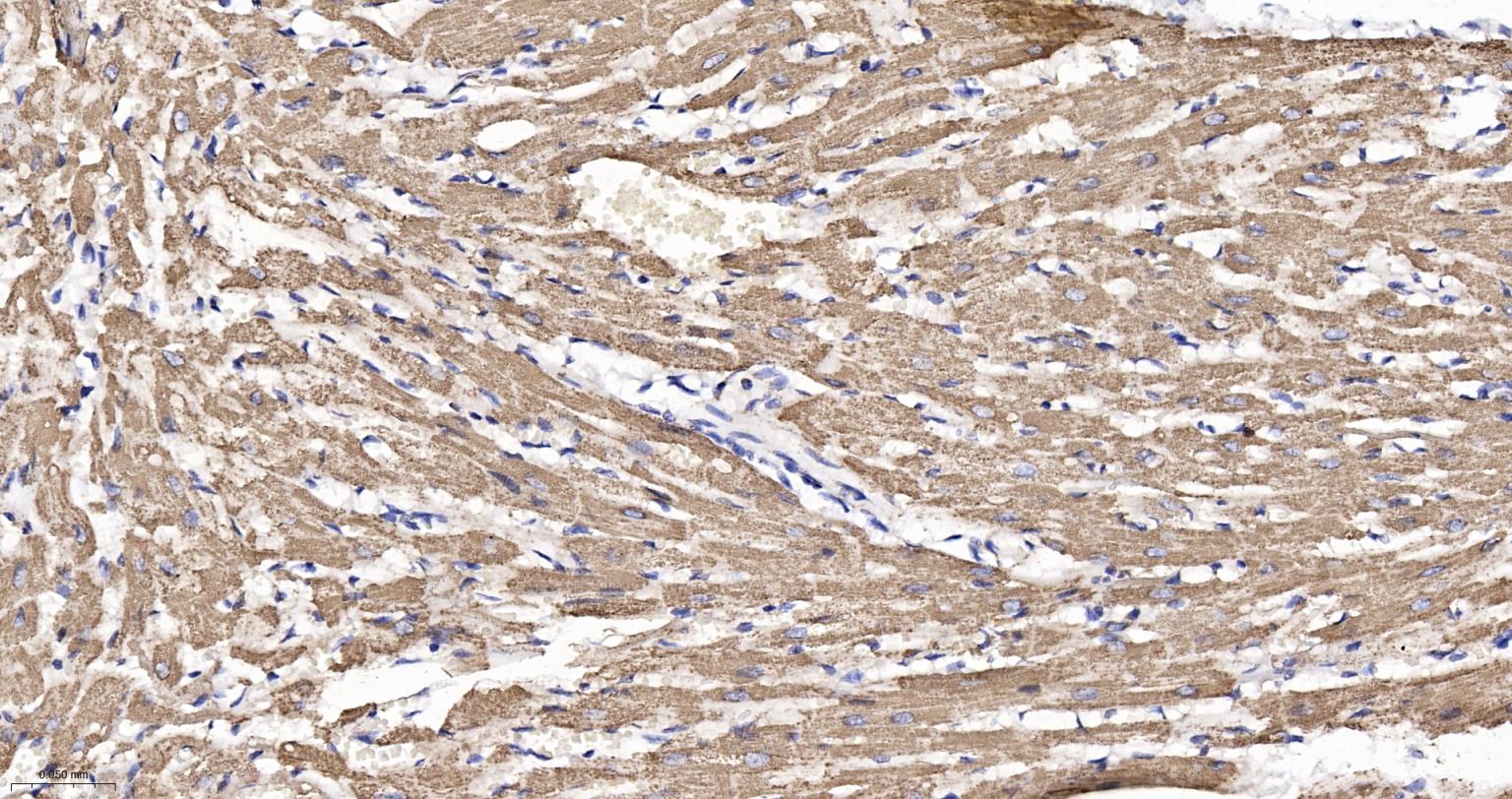 ATP合成酶β5重组兔单克隆抗体