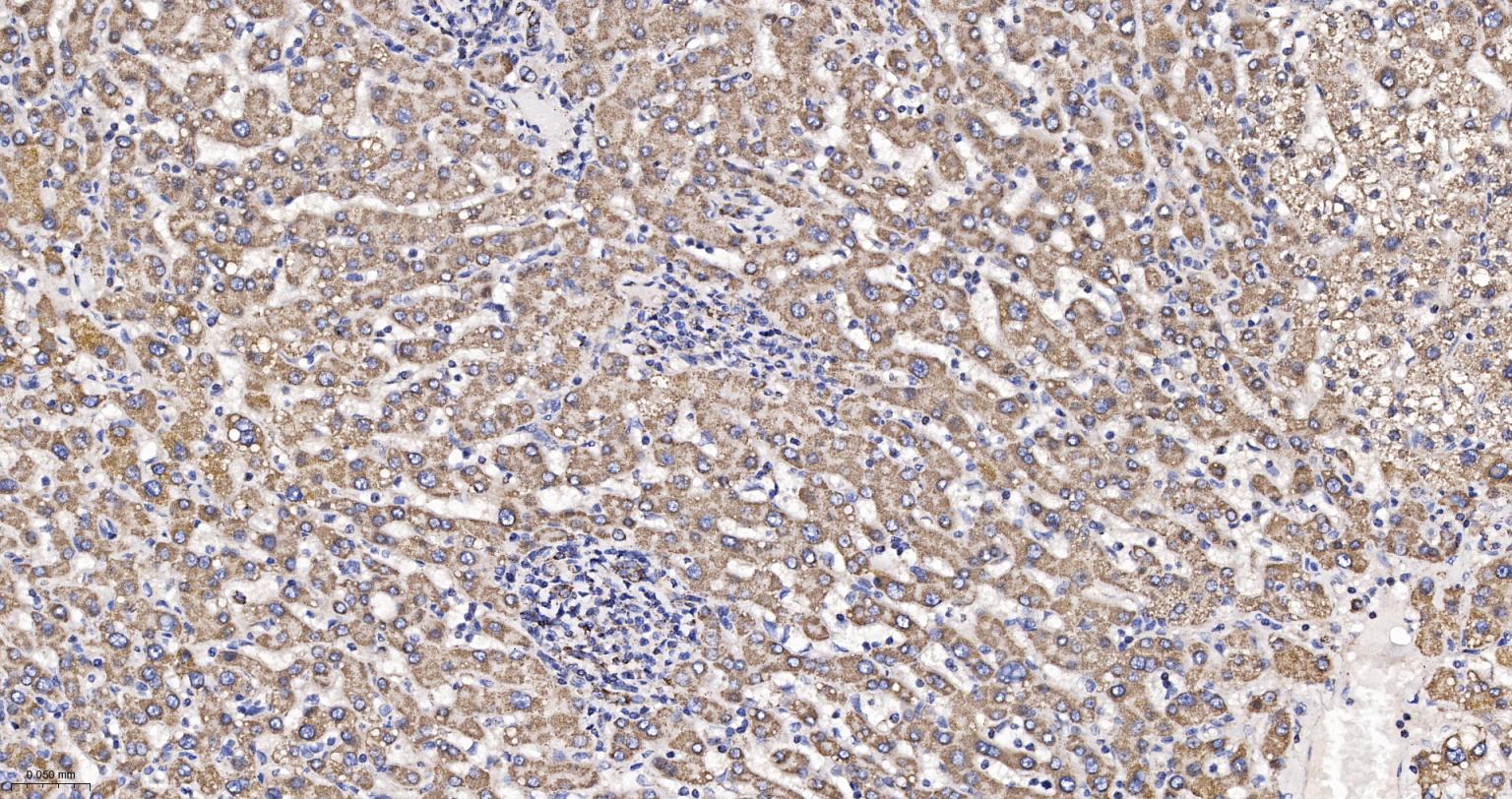 ATP合成酶β5重组兔单克隆抗体