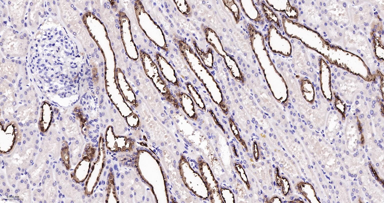 粘蛋白-1重组兔单抗