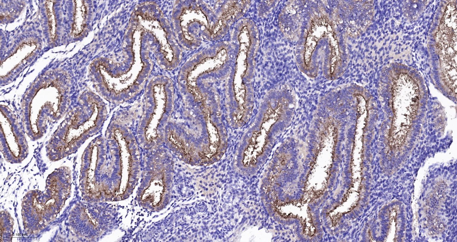 粘蛋白-1重组兔单抗