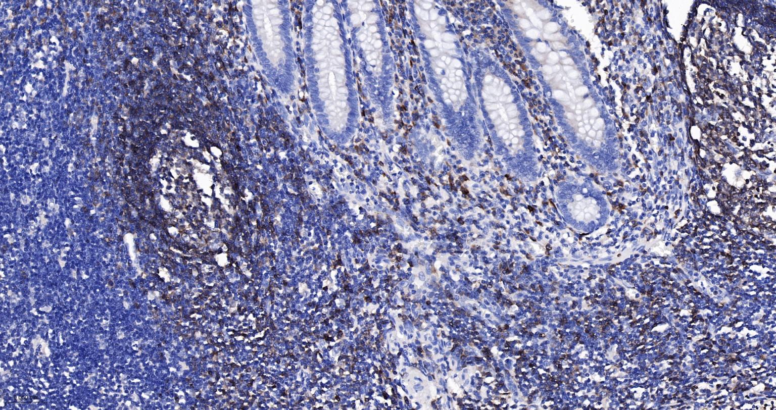 CD79A重组兔单克隆抗体