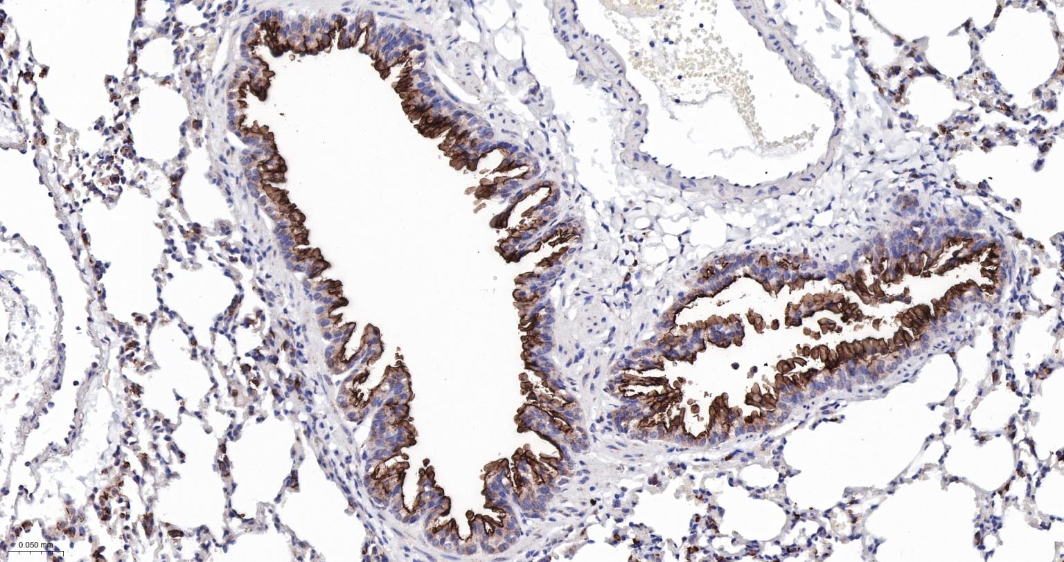 粘蛋白-1重组兔单抗
