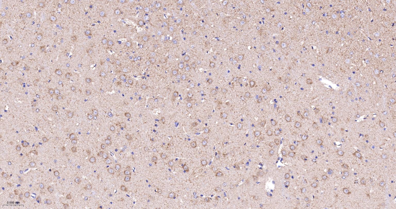 细胞色素C重组兔单抗