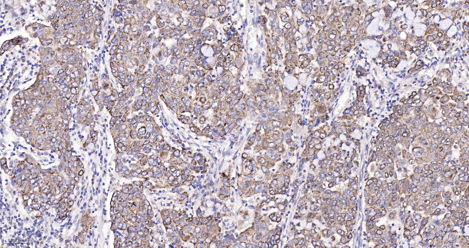 细胞色素C重组兔单抗