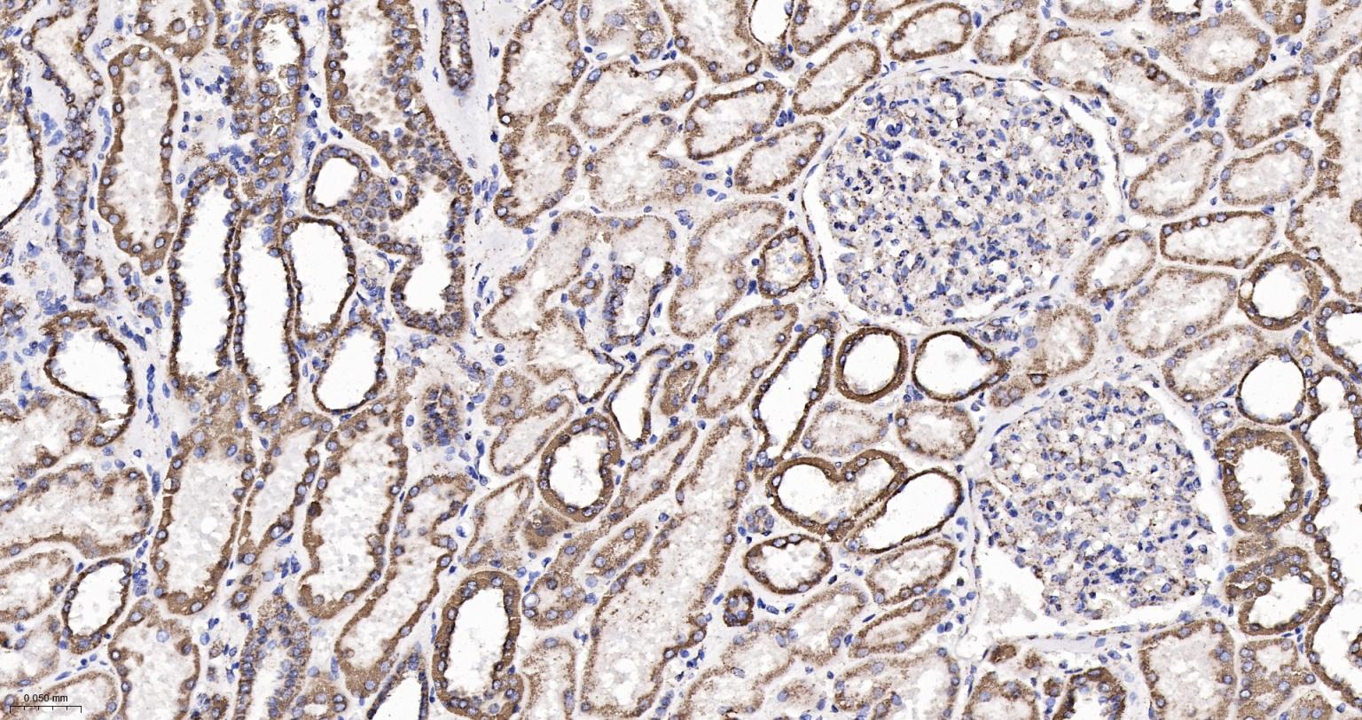 ATP合成酶β5重组兔单克隆抗体