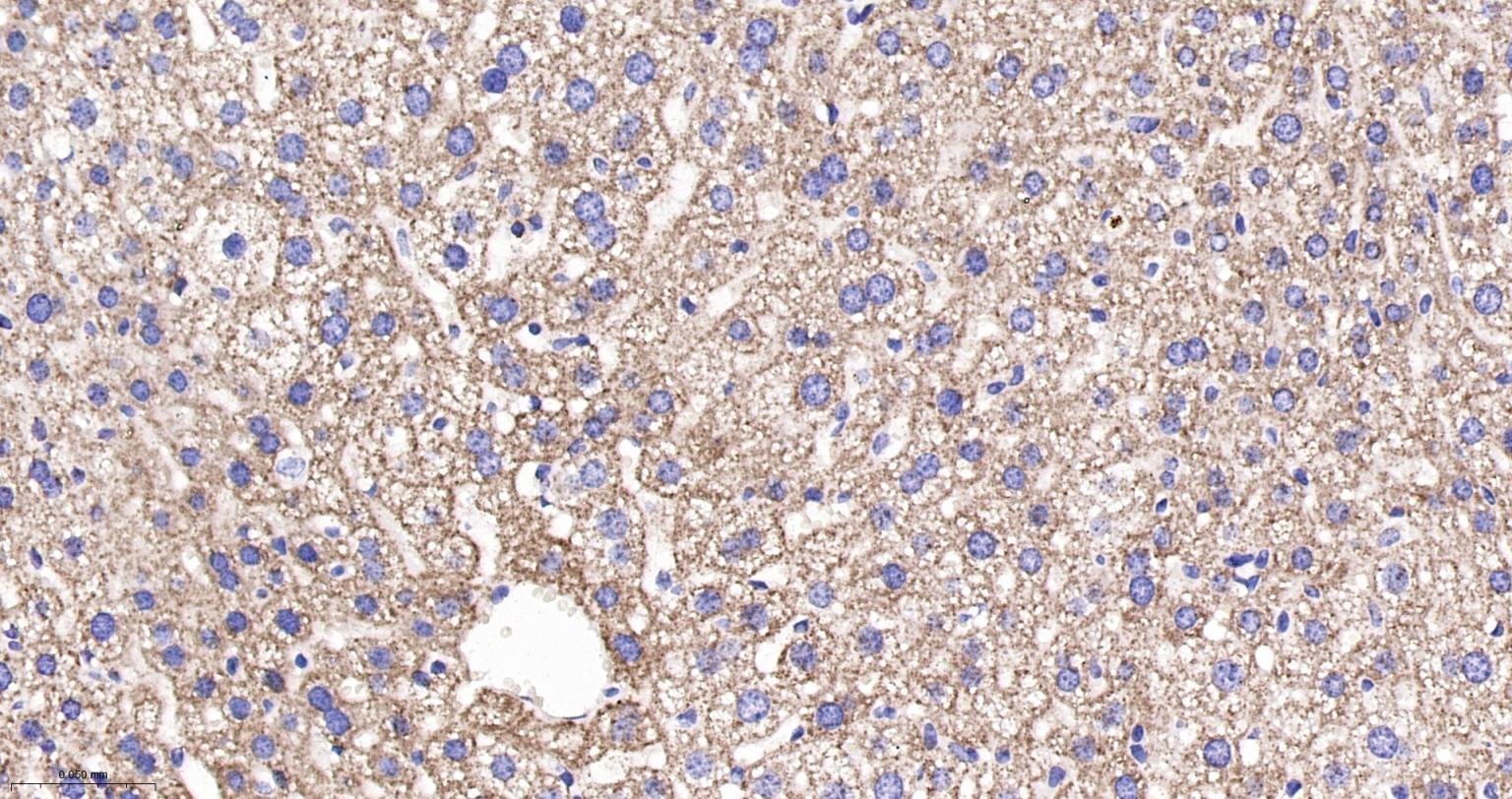 ATP合成酶β5重组兔单克隆抗体